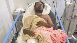 Nagesh Babu, the wanted acid attack accused, was shot in the leg by police after he allegedly tried to escape near Kengeri on Friday.